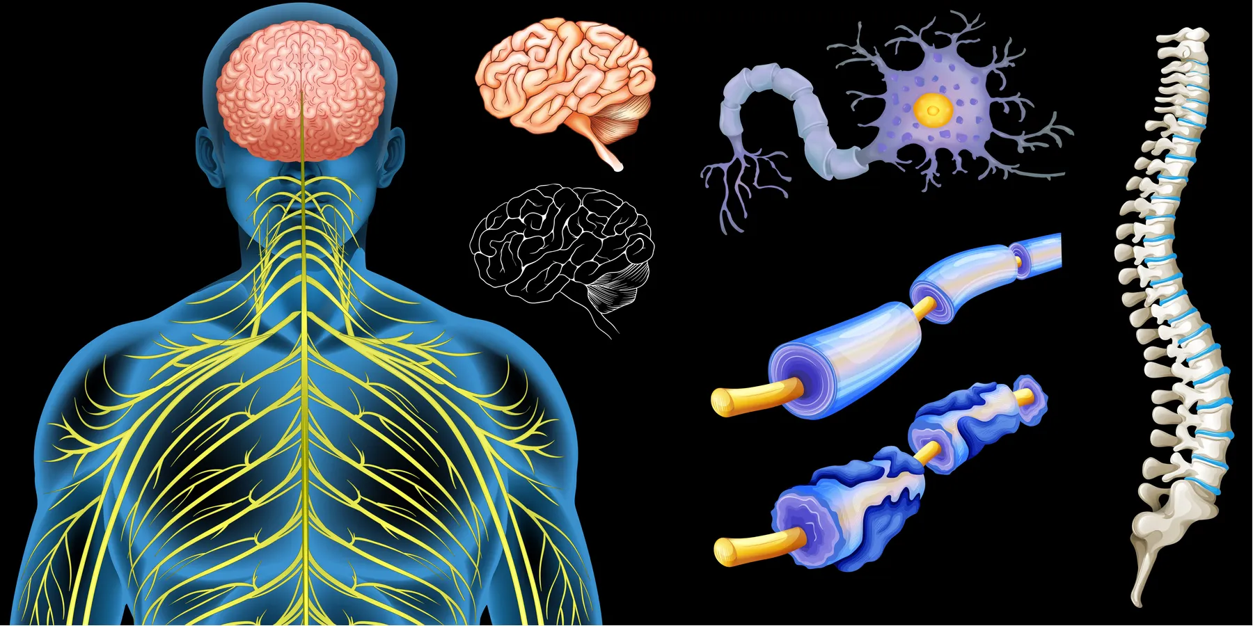 Multiple Sclerosis and Neuroimmunological Disorders